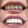 Whitening Munnskyll iD+