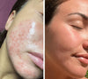 Technologie der Silky Planet LED Lichttherapie Gesichtsmaske – gezieltes Rot- und Infrarotlicht zur Stimulation der Kollagenbildung und Hautregeneration.