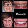 Whitening Munnskyll iD+