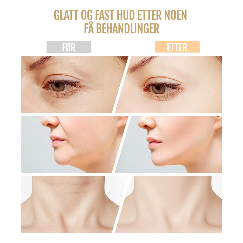 Micro Glow LED-lysterapienhet