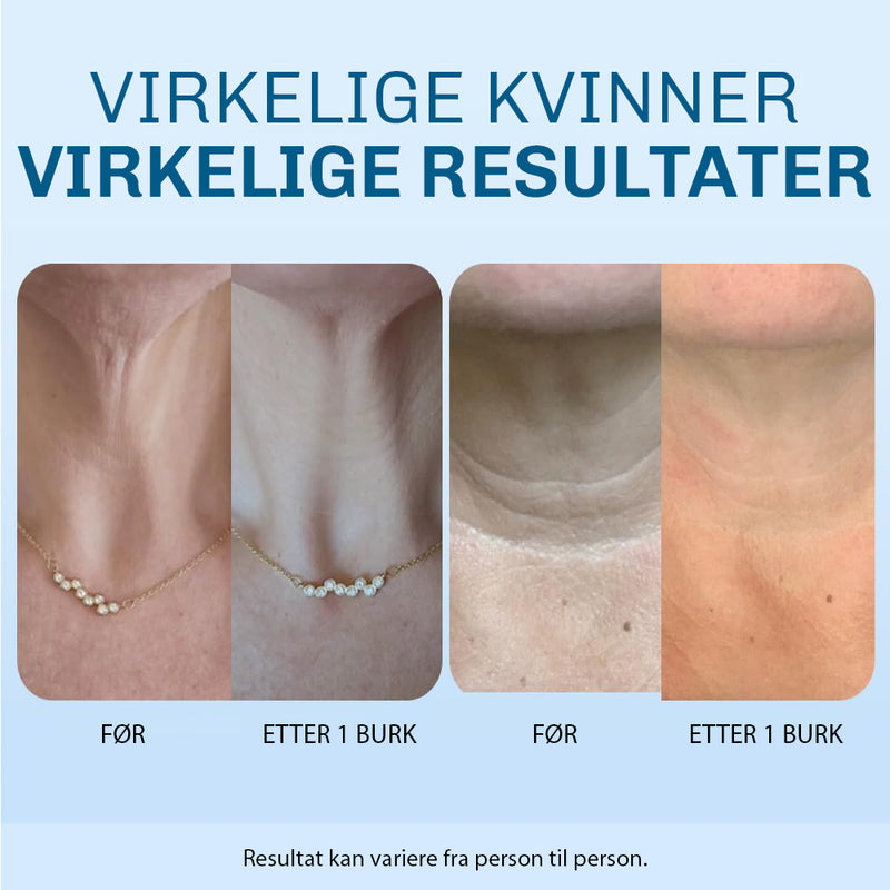 Liftingkrem for halslinjer