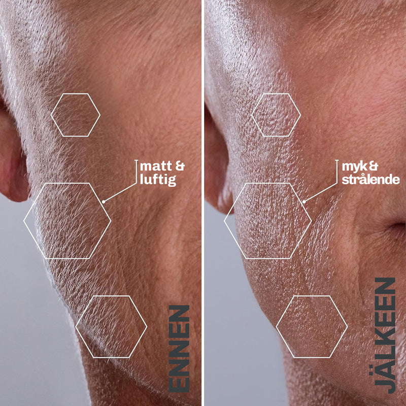 Ultralyd hårfjerning DIAMONDFLASH+