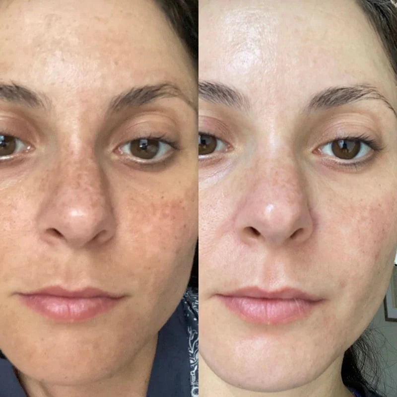 Kollagen liftingkrem