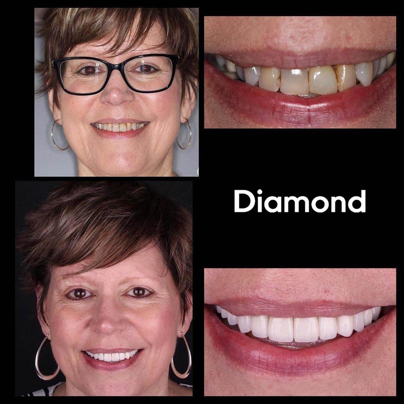 Whitening Munnskyll iD+