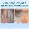 Anti age halspleie med hyaluronsyre