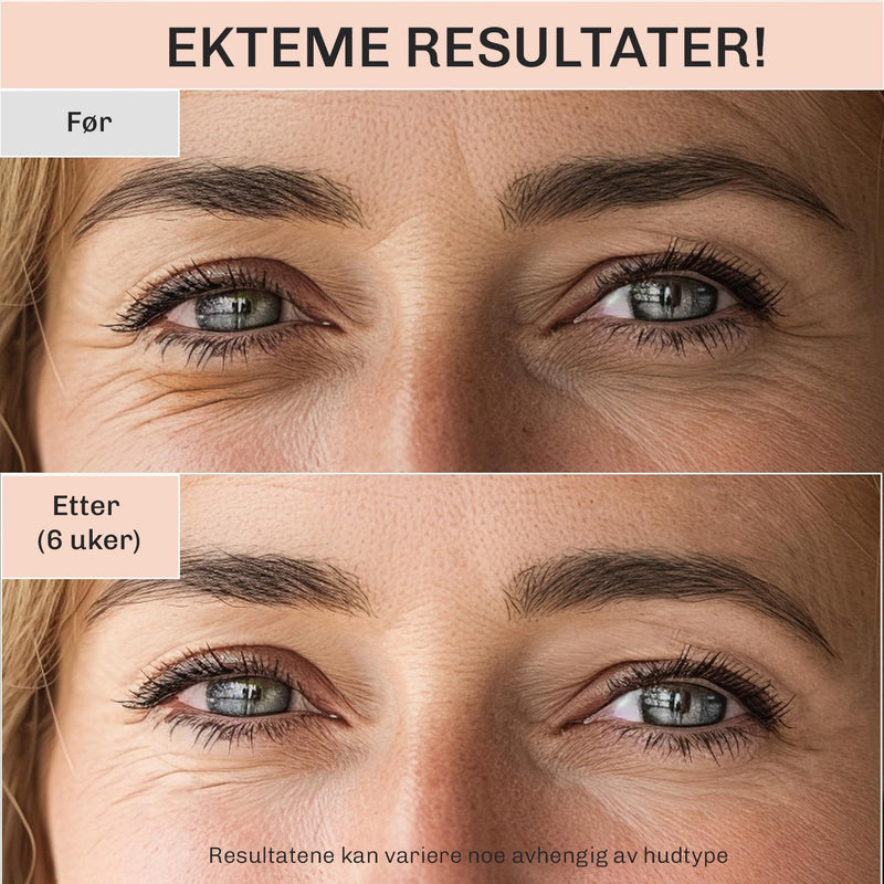 Anti age øyekrem med ginseng og retinal