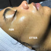 Oppladbar dermaplaning enhet for ansikt