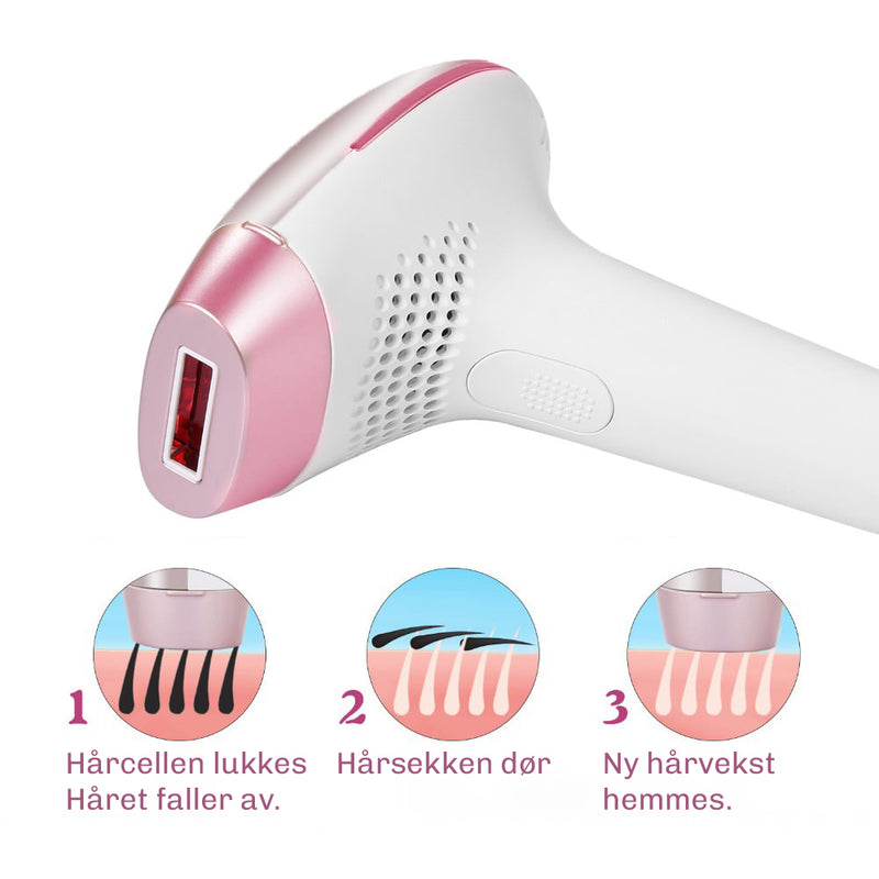 IPL laser hårfjerning som hemmer fremtidig hårvekst