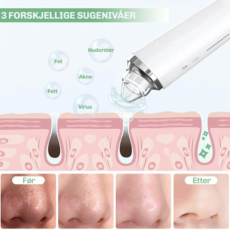 Vakuum pore renser for grundig og skånsom dyprens