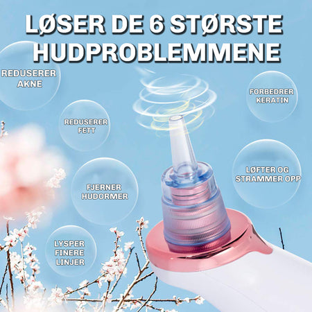 Diamond SkinClear 3 elektrisk hudormfjerner for dyprens