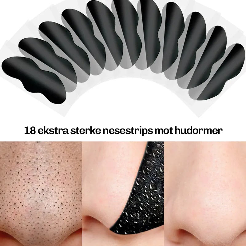 Porestrips anbefalt for ukentlig bruk