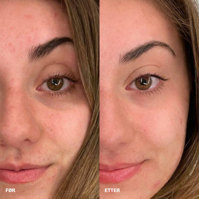 Retinal serum med peptider for økt elastisitet