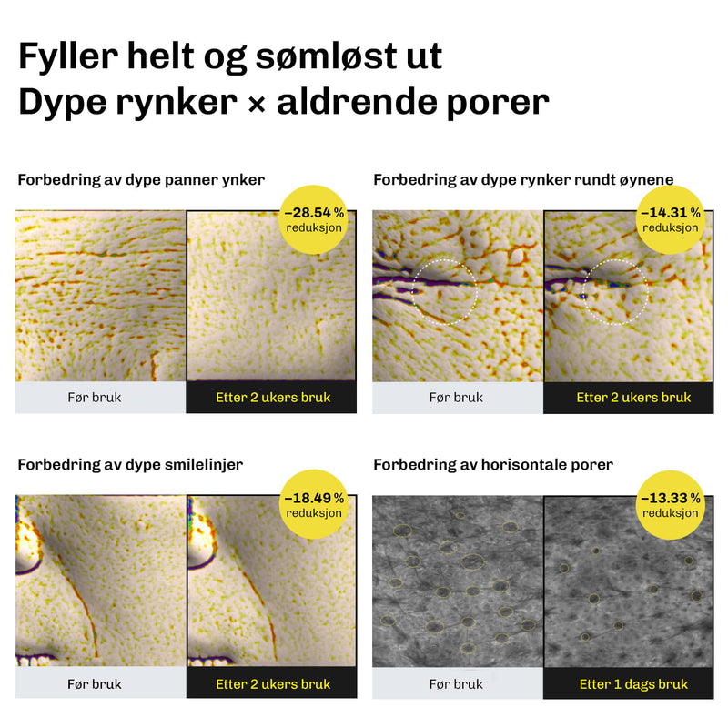 Retinal serum som effektivt steg i nattlig hudpleierutine