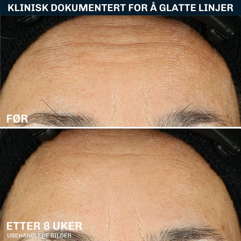 Retinol nattserum som bidrar til fastere hud og jevnere hudtone