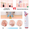 Diamond SkinClear 3 porefjerner for jevnere hud