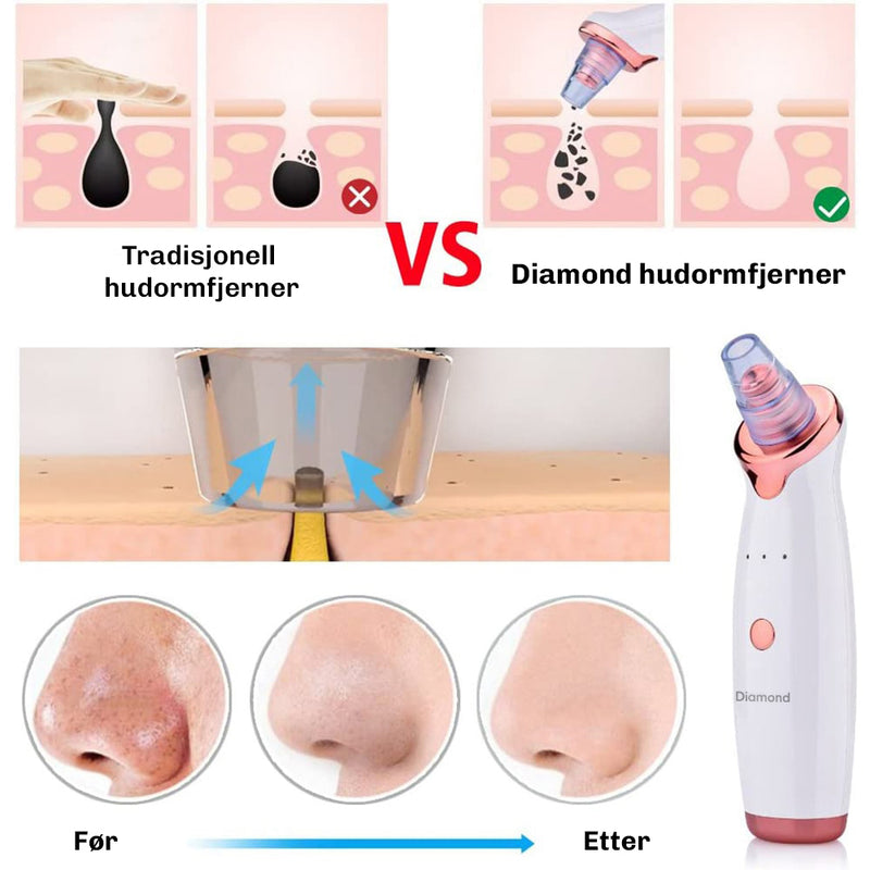 Diamond SkinClear 3 porefjerner for jevnere hud