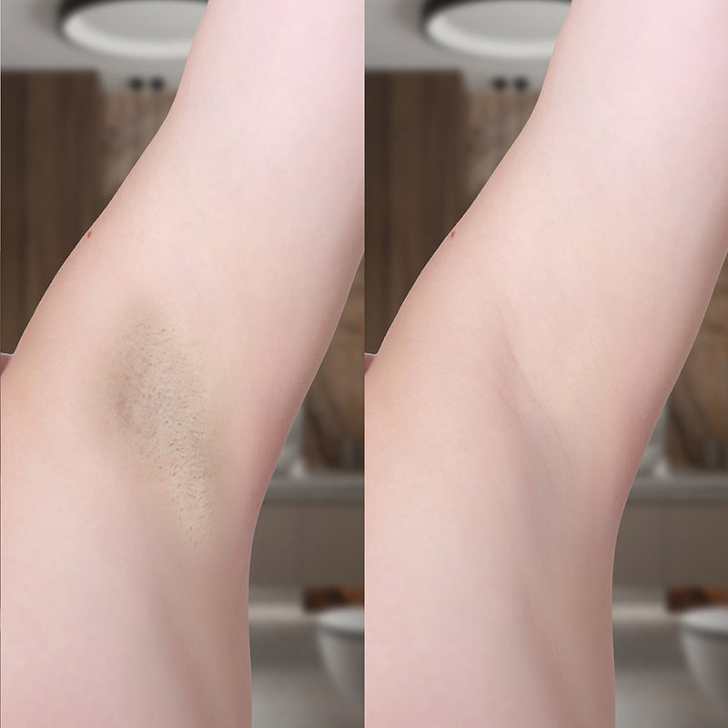 Smertefri hårfjerning med Lumi IPL